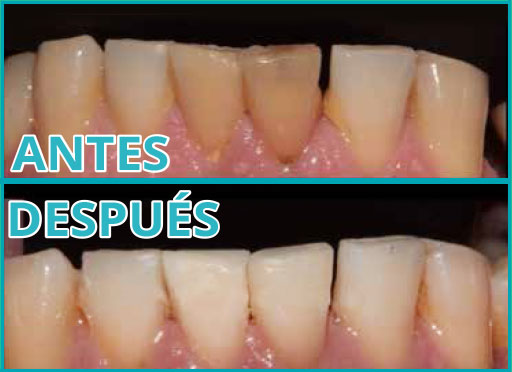 Aclaramiento Interno